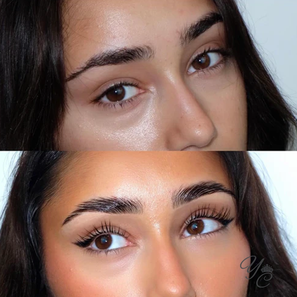 Beauty Treatments You Didn’t Know You Needed (But Will Wonder How You Lived Without)