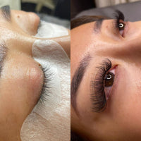 The Best You Before & After – You On Crown